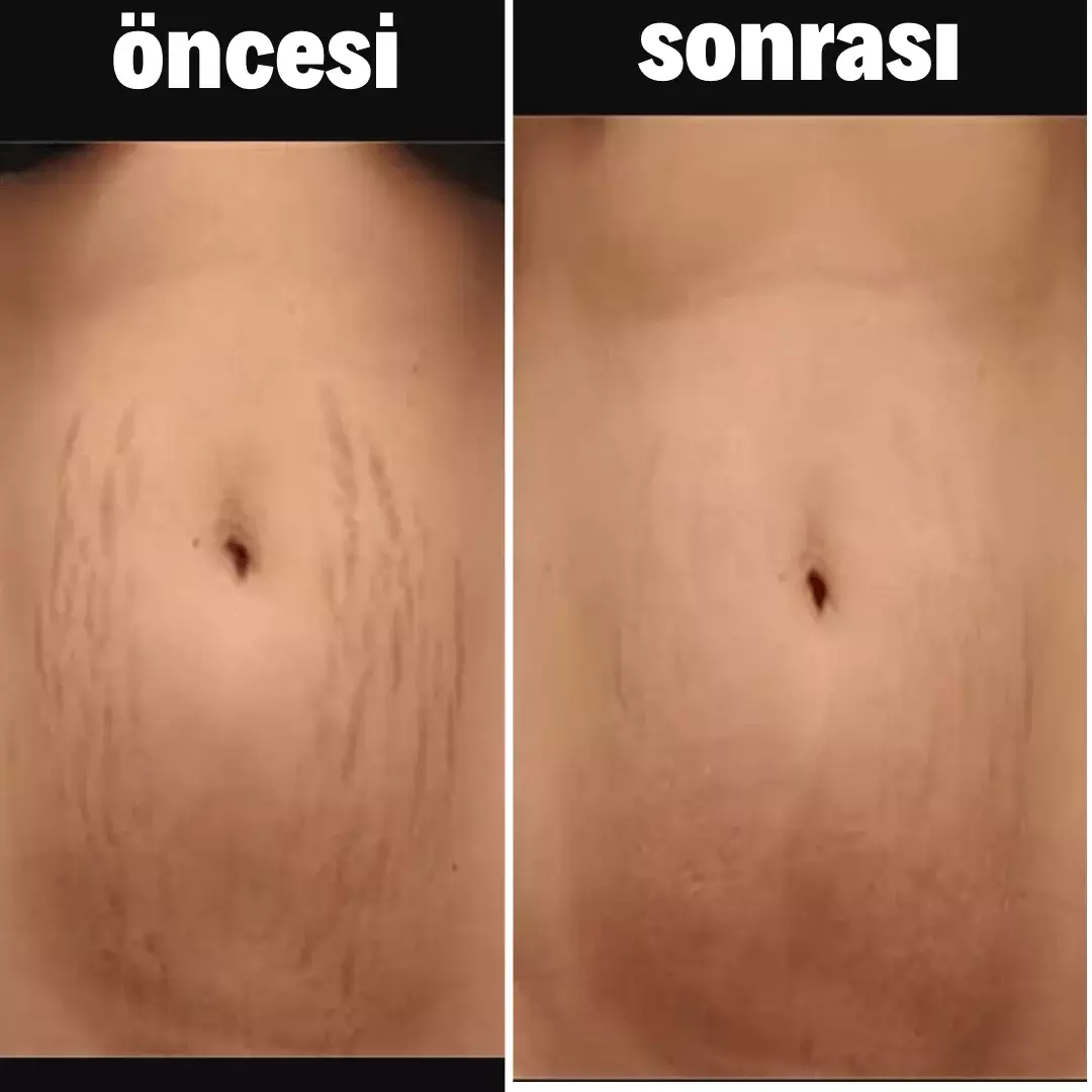 3-min