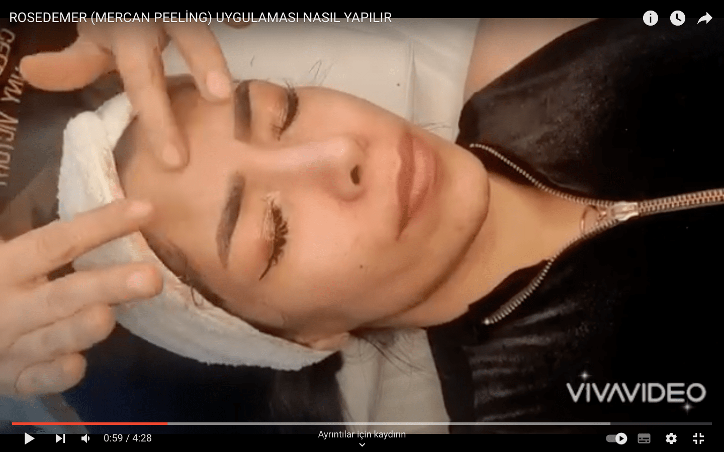 mercan peeling yaptıranların yorumları