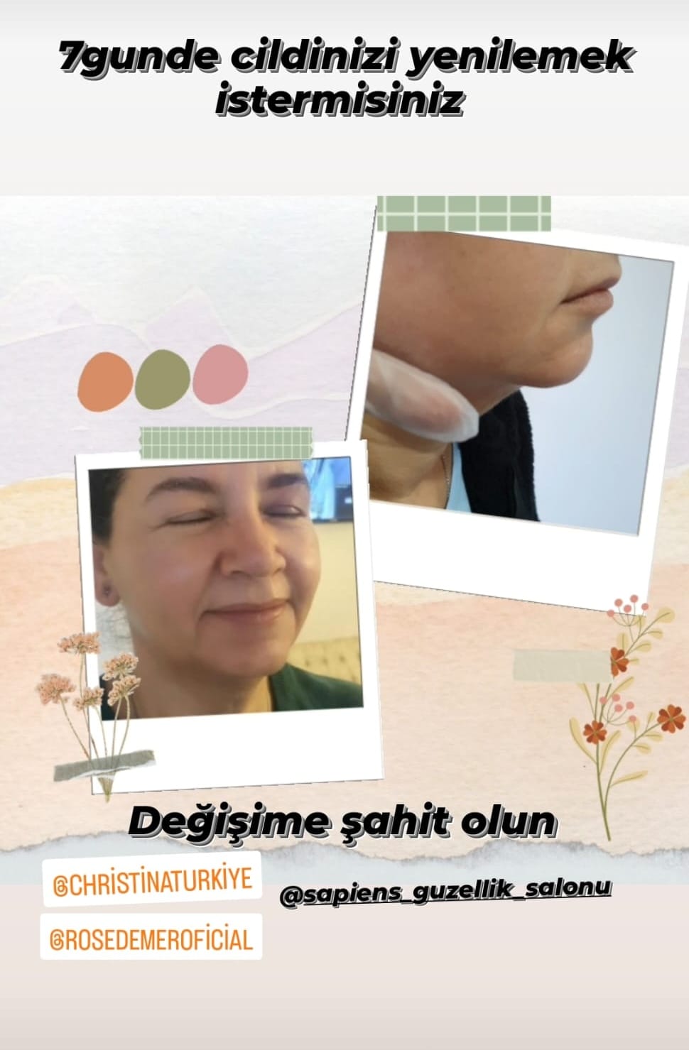 cilt bakımı